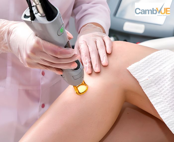 Diploma in Laser & Light - Based Hair Removal